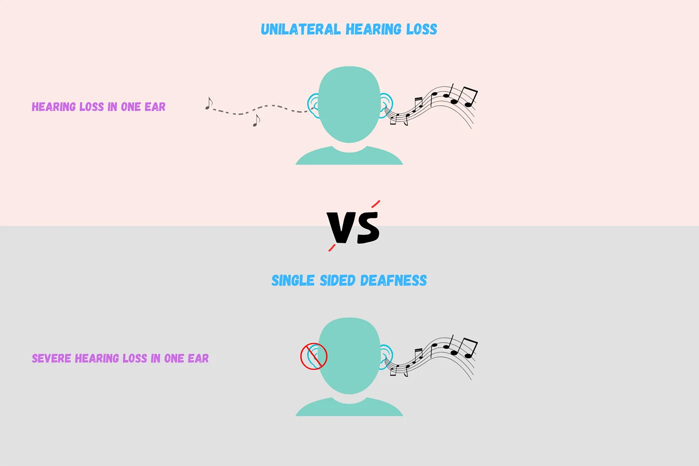12-Jul-2023-unilateral-hearing-loss-single-sided-deafness