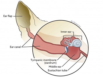 24-feb-2022-what-is-hearing-loss-and-is-it-reversible