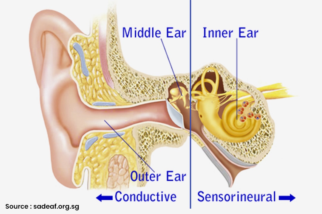 27-oct-2022-exploring-the-different-types-of-hearing-loss-causes-symptoms-and-treatments
