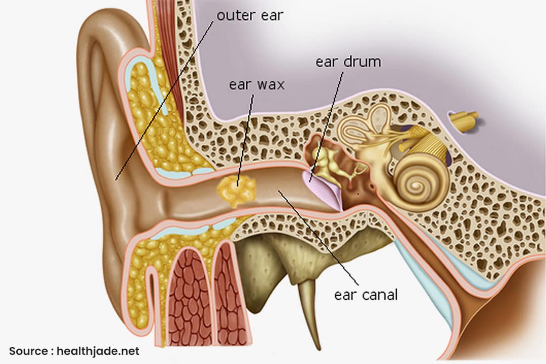 27-oct-2022-exploring-the-different-types-of-hearing-loss-causes-symptoms-and-treatments