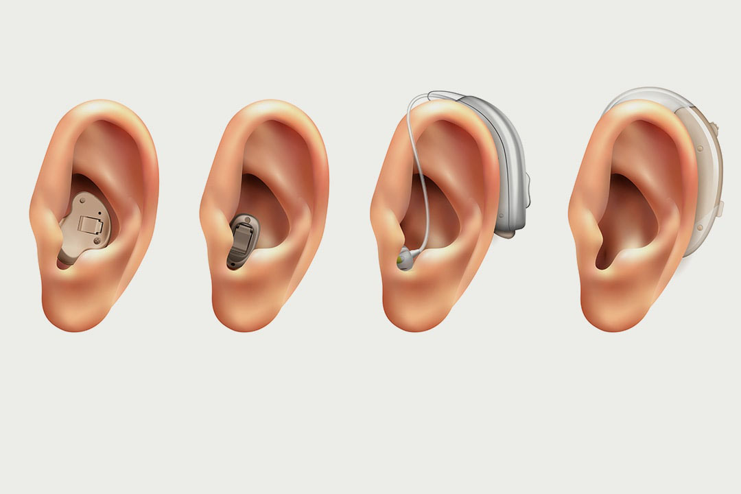 19-feb-2024-3-reasons-to-visit-an-audiologist-or-hearing-care-consultant