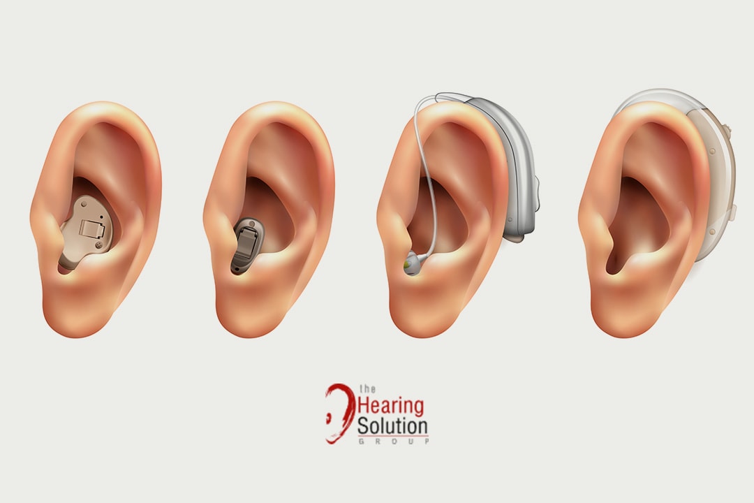 19-feb-2024-3-reasons-to-visit-an-audiologist-or-hearing-care-consultant