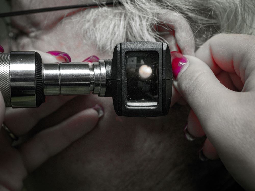 23-aug-2024-the-3-types-of-hearing-loss-causes-symptoms-other-essential-info