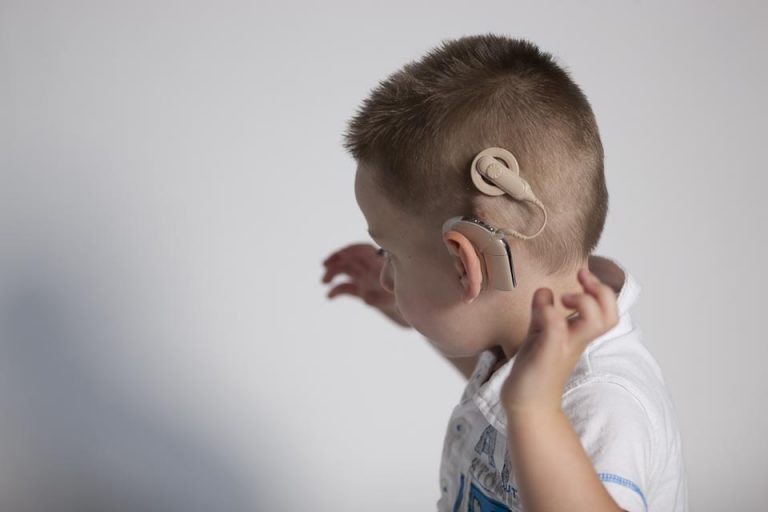 WHAT IS COCHLEAR IMPLANT?